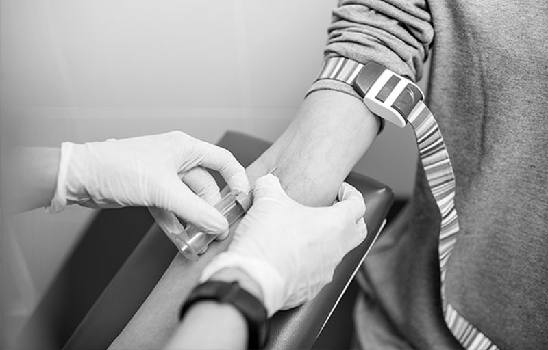 Chemical Bodily Alcohol Testing close up of doctor's hands taking blood from arm of drunk driver for blood alcohol test for DUI charge